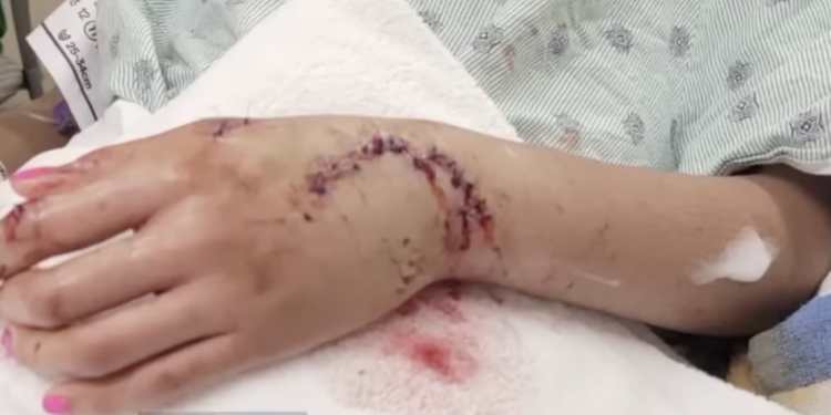 상어에게 물리자 ‘펀치’ 날린 10대 여성 … “위험천만한 순간”